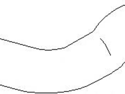 Furtun ear supraalimentare AUDI A4 (8E2, B6), AUDI A4 Avant (8E5, B6) - TOPRAN 113 560